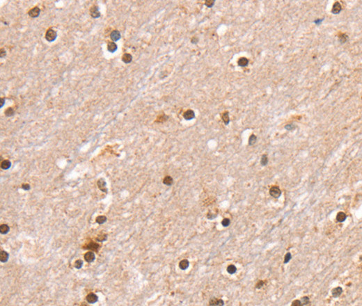 Immunohistochemistry of paraffin-embedded Human brain  using SMARCB1 Polyclonal Antibody at dilution of 1:30