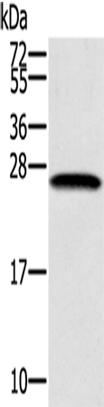 Western Blot analysis of K562 cell using SSX1 Polyclonal Antibody at dilution of 1:400