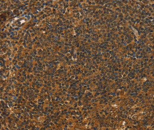 Immunohistochemistry of paraffin-embedded Human tonsil tissue using STAR Polyclonal Antibody at dilution 1:40