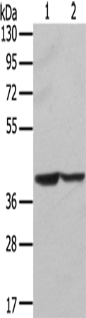 Western Blot analysis of Hela and hepg2 cell using STX16 Polyclonal Antibody at dilution of 1:400