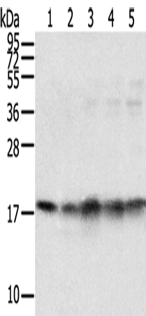 Western Blot analysis of Mouse brain and heart tissue, Jurkat, K562 and hela cell using TAF11 Polyclonal Antibody at dilution of 1:800