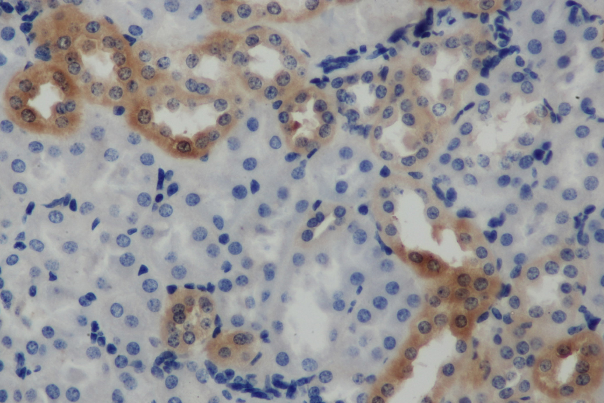 Immunohistochemistry of paraffin-embedded Mouse kidney using ARF6 Polyclonal Antibody at dilution of 1:50