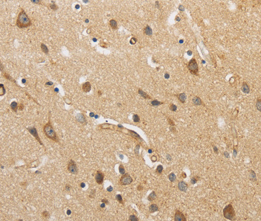 Immunohistochemistry of paraffin-embedded Human brain  using ARF6 Polyclonal Antibody at dilution of 1:30