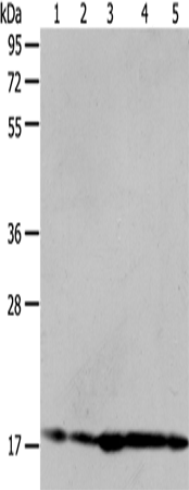 Western Blot analysis of Hela and 293T cell, Mouse liver tissue, A431 and MCF-7 cell using ARF6 Polyclonal Antibody at dilution of 1:450