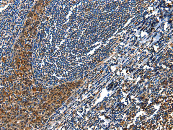 Immunohistochemistry of paraffin-embedded Human tonsil  tissue using AQP2 Polyclonal Antibody at dilution 1:100