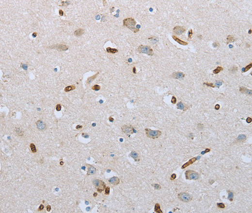 Immunohistochemistry of paraffin-embedded Human brain tissue using FGF1 Polyclonal Antibody at dilution 1:50