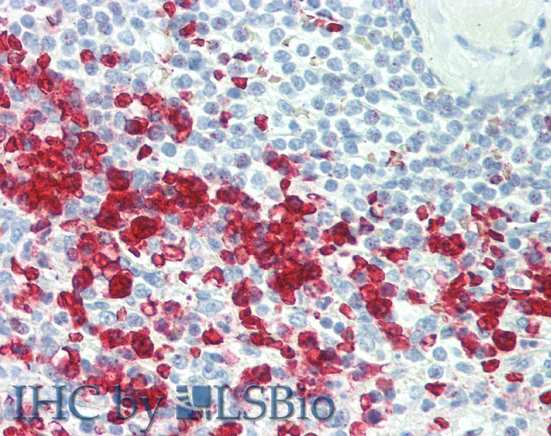 Immunohistochemistry of paraffin-embedded Spleen tissue using CCL17 Polyclonal Antibody at dilution of 1:100 .