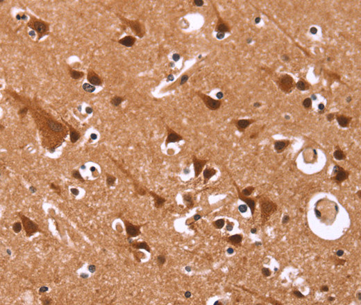 Immunohistochemistry of paraffin-embedded Human brain tissue using Cyclin D3 Polyclonal Antibody at dilution 1:40