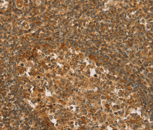 Immunohistochemistry of paraffin-embedded Human tonsil tissue using SLC6A3 Polyclonal Antibody at dilution 1:50