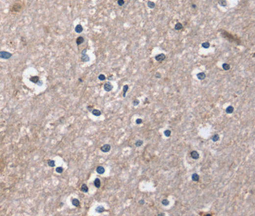 Immunohistochemistry of paraffin-embedded Human brain using DUT Polyclonal Antibody at dilution of 1:30