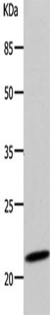 Western Blot analysis of 293T cell using DUT Polyclonal Antibody at dilution of 1:500