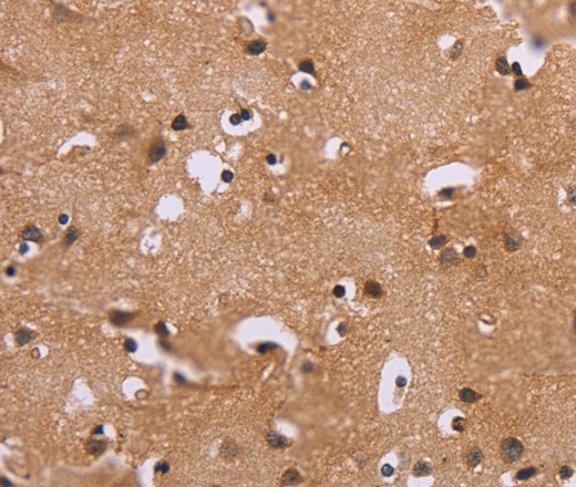 Immunohistochemistry of paraffin-embedded Human brain  using ERK1/2 Polyclonal Antibody at dilution of 1:30