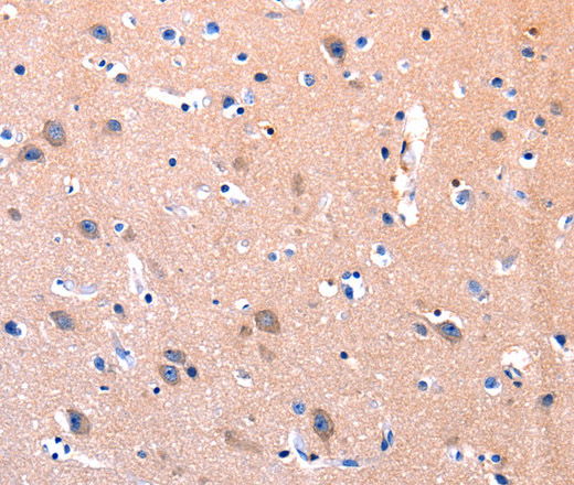 Immunohistochemistry of paraffin-embedded Human brain using FAK Polyclonal Antibody at dilution of 1:75