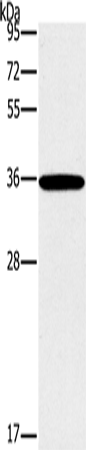 Western Blot analysis of 231 cell using FOSL1 Polyclonal Antibody at dilution of 1:615