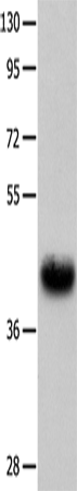 Western Blot analysis of Human fetal muscle tissue   using UTS2R Polyclonal Antibody at dilution of 1:400