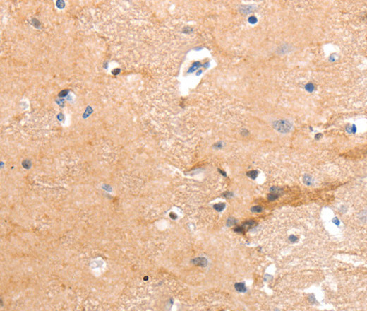 Immunohistochemistry of paraffin-embedded Human brain tissue using GPR64 Polyclonal Antibody at dilution 1:55