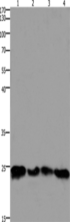 Western Blot analysis of 293T and hela cell, Mouse lung and brain tissue using HMGB3 Polyclonal Antibody at dilution of 1:400