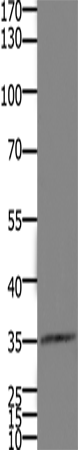 Western Blot analysis of Mouse kidney tissue using HOXD11 Polyclonal Antibody at dilution of 1:1100