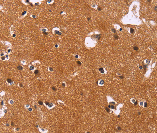 Immunohistochemistry of paraffin-embedded Human brain  using CBX3 Polyclonal Antibody at dilution of 1:40