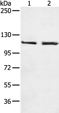 Western Blot analysis of Human fetal liver tissue using TERT Polyclonal Antibody at dilution of 1:200