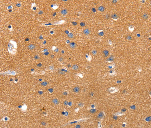 Immunohistochemistry of paraffin-embedded Human brain tissue using JAK2 Polyclonal Antibody at dilution 1:35