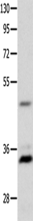 Western Blot analysis of Mouse intestinum tenue tissue   using MC1R Polyclonal Antibody at dilution of 1:1450