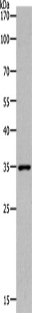 Western Blot analysis of Human fetal kidney tissue using MC2R Polyclonal Antibody at dilution of 1:1400