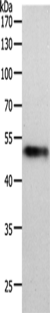 Western Blot analysis of Human lung tissue using MIDN Polyclonal Antibody at dilution of 1:1000