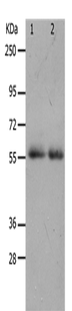 Western Blot analysis of K562 cell and Human colon cancer tissue using MMP17 Polyclonal Antibody at dilution of 1:900