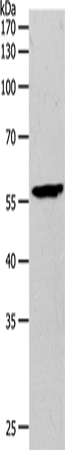 Western Blot analysis of Mouse brain tissue using MMP27 Polyclonal Antibody at dilution of 1:500