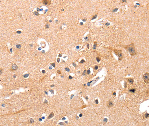 Immunohistochemistry of paraffin-embedded Human brain using YWHAG Polyclonal Antibody at dilution of 1:50