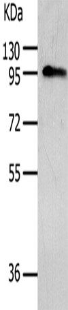 Western Blot analysis of Human liver cancer tissue using AKAP8 Polyclonal Antibody at dilution of 1:500