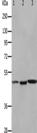 Western Blot analysis of Mouse kidney , brain and heart tissue using HCRTR2 Polyclonal Antibody at dilution of 1:1100