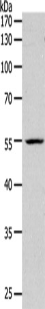 Western Blot analysis of K562 cell using PAX1 Polyclonal Antibody at dilution of 1:1200