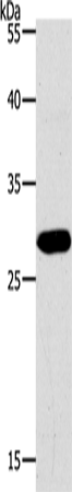 Western Blot analysis of Jurkat cell using PAX5 Polyclonal Antibody at dilution of 1:550