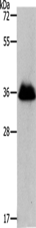 Western Blot analysis of NIH/3T3 cell using RNF126 Polyclonal Antibody at dilution of 1:1050