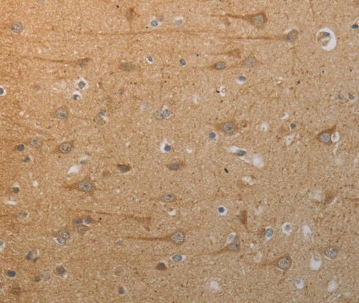 Immunohistochemistry of paraffin-embedded Human brain tissue using SLC4A7 Polyclonal Antibody at dilution 1:50