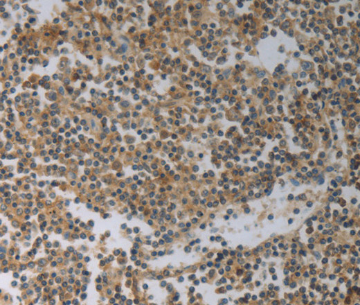 Immunohistochemistry of paraffin-embedded Human tonsil tissue using SLC4A7 Polyclonal Antibody at dilution 1:50