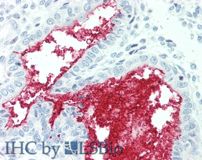 Immunohistochemistry of paraffin-embedded Human Uterus tissue using SLC34A2 Polyclonal Antibody at dilution of 1:60.