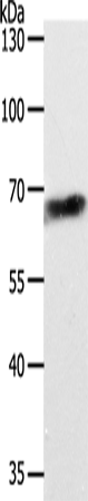 Western Blot analysis of Jurkat cell using ABCD4 Polyclonal Antibody at dilution of 1:700