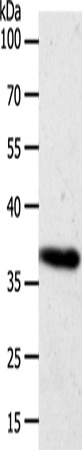 Western Blot analysis of Hela cell using AKR1B1 Polyclonal Antibody at dilution of 1:700