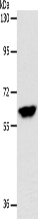 Western Blot analysis of Mouse brain tissue using INA Polyclonal Antibody at dilution of 1:500