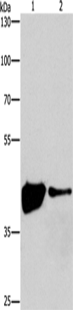 Western Blot analysis of 293T and Human fetal brain tissue using MAPK11  Polyclonal Antibody at dilution of 1:200