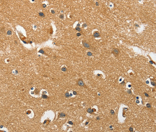 Immunohistochemistry of paraffin-embedded Human brain tissue using EPHB3 Polyclonal Antibody at dilution 1:40