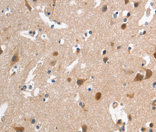 Immunohistochemistry of paraffin-embedded Human brain tissue using CD168 Polyclonal Antibody at dilution 1:40