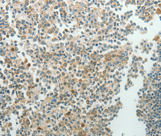 Immunohistochemistry of paraffin-embedded Human tonsil using NDRG3 Polyclonal Antibody at dilution of 1:70