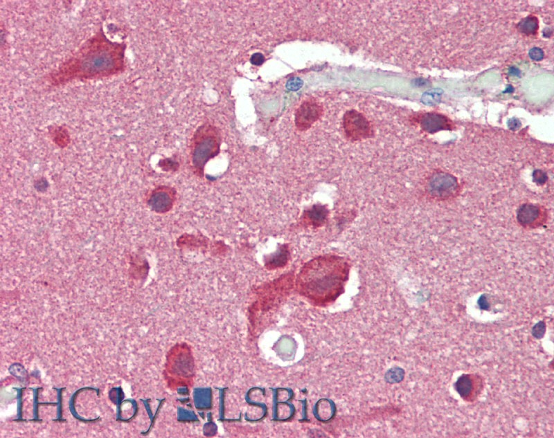 Immunohistochemistry of paraffin-embedded Brain, Cortex tissue using SLC8A3 Polyclonal Antibody at dilution of 1:50.