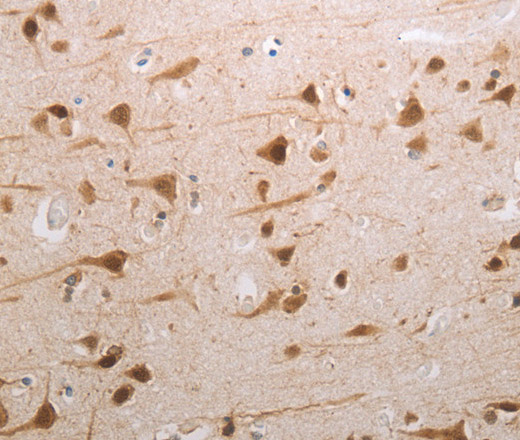 Immunohistochemistry of paraffin-embedded Human brain tissue using MDC1 Polyclonal Antibody at dilution 1:80