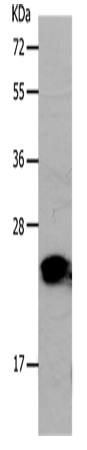 Western Blot analysis of Human liver cancer tissue using PNOC Polyclonal Antibody at dilution of 1:1200