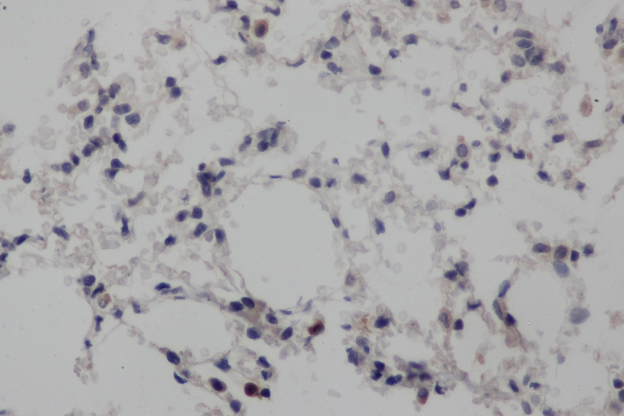 Immunohistochemistry of paraffin-embedded Rat lung using NOTCH1 Polyclonal Antibody at dilution of 1:50